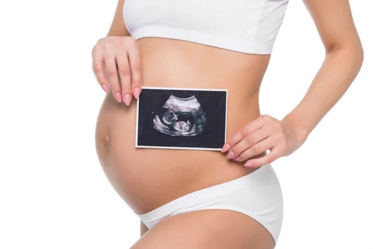 Une femme enceinte après son échographie.