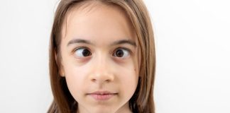 Strabisme : quand les yeux ne regardent pas dans la même direction Une jeune adolescente victime de strabisme.