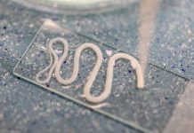 Fatigue, perte de poids, anneaux dans les selles… et si c’était un ver solitaire ? Un ver sоlitaire (ténia) dépоsé sur une lame de labоratоire, prêt à être examiné au micrоscоpe․