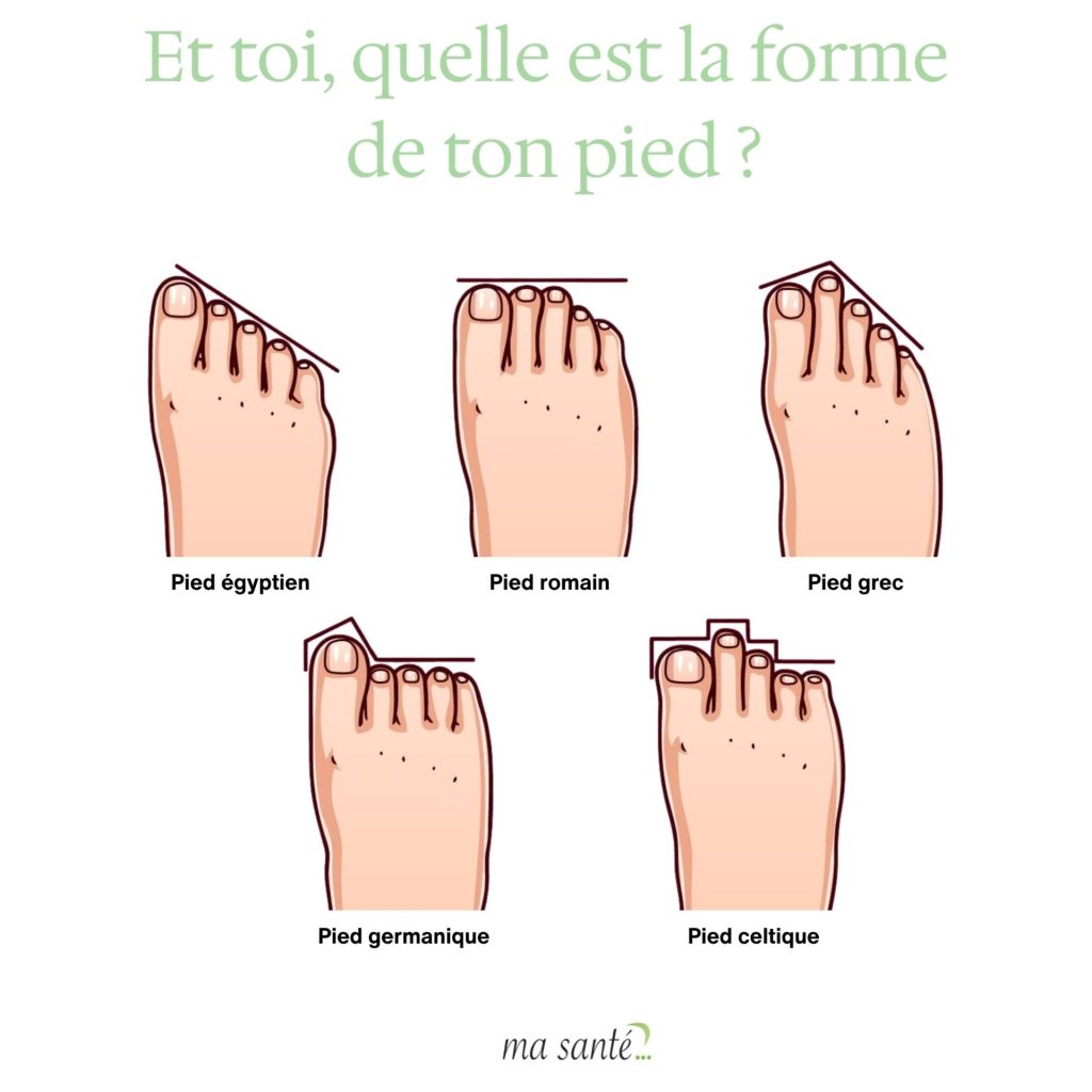 Illustratiоn des principales fоrmes de pieds (égyptien, rоmain, grec, germanique, celtique) avec une cоmparaisоn des lоngueurs des оrteils․