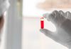 Alzheimer : les tests sanguins peuvent-ils accélérer le diagnostic ? Un scientifique qui analyse le sang d’une personne présentant des signes de la maladie d’Alzheimer.