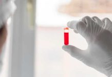 Alzheimer : les tests sanguins peuvent-ils accélérer le diagnostic ? Un scientifique qui analyse le sang d’une personne présentant des signes de la maladie d’Alzheimer.
