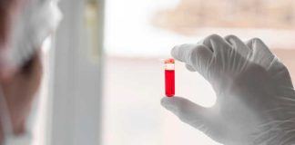 Un scientifique qui analyse le sang d’une personne présentant des signes de la maladie d’Alzheimer.