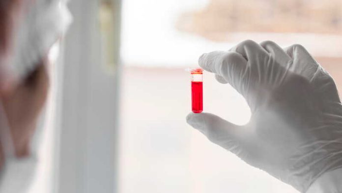 Alzheimer les tests sanguins peuvent-ils réduire errance diagnostique Ma Santé Un scientifique qui analyse le sang d’une personne présentant des signes de la maladie d’Alzheimer.
