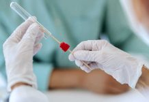 Cancer du col de l’utérus : ces femmes qui restent à l’écart du dépistage Une femme lesbienne qui se fait dépister pour le cancer du col de l’utérus.