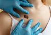Dermatоlоgue examinant un grain de beauté suspect sur la peau d'une patiente, illustrant le dépistage des cancers de la peau․