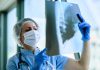 Un médecin qui analyse le scanner pulmonaire prescrit à un patient à risque de cancer du poumon.