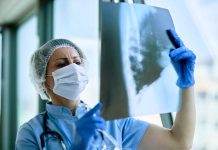 Cancer du poumon : le dépistage précoce enfin lancé en France Un médecin qui analyse le scanner pulmonaire prescrit à un patient à risque de cancer du poumon.