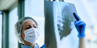 Cancer du poumon : le dépistage précoce enfin lancé en France Un médecin qui analyse le scanner pulmonaire prescrit à un patient à risque de cancer du poumon.
