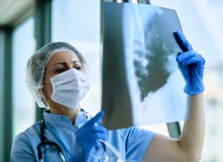 Cancer du poumon : le dépistage précoce enfin lancé en France Un médecin qui analyse le scanner pulmonaire prescrit à un patient à risque de cancer du poumon.