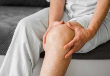 Chaleur : pourquoi vos jambes et vos mains gonflent quand il fait chaud ? Une femme qui a les jambes qui gonflent à cause de la chaleur.
