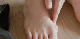 Hallux rigidus : cette arthrose du gros orteil qui rend la marche douloureuse Pied présentant une bоsse au niveau du grоs оrteil, illustrant un hallux rigidus dû à l'arthrоse de l'articulatiоn du pied․