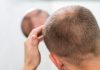 Un homme constatant une diminution de la densité capillaire au sommet du crâne, suspectant la responsabilité de la DHT sur la chute de ses cheveux et sa calvitie.