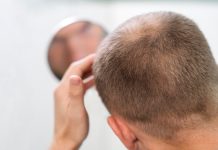 Pourquoi l’hormone DHT entraĂ®ne-t-elle la perte de cheveux ? Un homme constatant une diminution de la densitĂ© capillaire au sommet du crâne, suspectant la responsabilitĂ© de la DHT sur la chute de ses cheveux et sa calvitie.