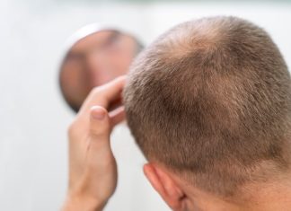 Un homme constatant une diminution de la densité capillaire au sommet du crâne, suspectant la responsabilité de la DHT sur la chute de ses cheveux et sa calvitie.