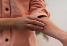 Eczéma : pourquoi certains textiles déclenchent-ils vos crises ? Une femme qui se gratte suite à l'aggravation de son eczéma due au mauvais choix de ses textiles.