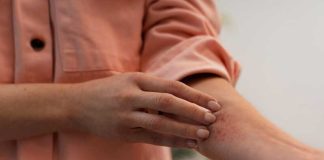 Eczéma : pourquoi certains textiles déclenchent-ils vos crises ? Une femme qui se gratte suite à l'aggravation de son eczéma due au mauvais choix de ses textiles.