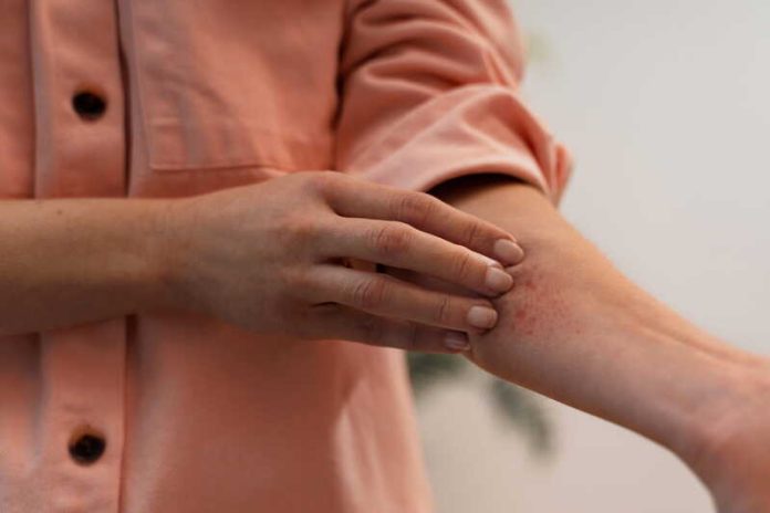 Pourquoi certains textiles déclenchent-ils vos crises d’eczéma Ma Santé Une femme qui se gratte suite à l'aggravation de son eczéma due au mauvais choix de ses textiles.