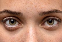 Pupilles dilatées : quelles sont les causes et quand s’inquiéter ? Une jeune femme qui présente des pupilles dilatées sans raisons apparentes.