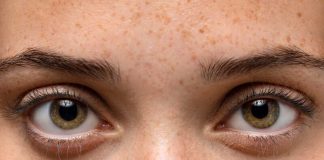 Pupilles dilatées : quelles sont les causes et quand s’inquiéter ? Une jeune femme qui présente des pupilles dilatées sans raisons apparentes.