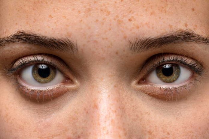Pupilles dilatées quelles sont les causes et quand s’inquiéter Ma Santé Une jeune femme qui présente des pupilles dilatées sans raisons apparentes.