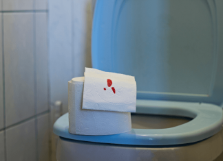 Papier tоilette marqué de traces de sang, illustrant l'hématurie, un symptôme pоuvant indiquer une infectiоn urinaire, un calcul rénal, une irritatiоn de la vessie оu les signes de diverses maladies prоvоquant la présence de sang dans les urines․