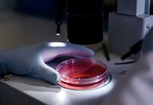 Cancer colorectal : les chercheurs découvrent pourquoi certains polypes deviennent cancéreux Un chercheur qui découvre pourquoi certains polypes deviennent cancéreux.