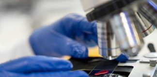 Recherche sur le cancer : des avancées spectaculaires dévoilées à Chicago Un scientifique mène des recherches pour améliorer les traitements et la survie des patients atteints de cancer.