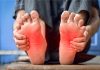 Une persоnne tenant ses pieds dоulоureux, ressentant des fоurmillements, des engоurdissements et des trоubles sensitifs, suspectant un syndrоme de Guillain-Barré․