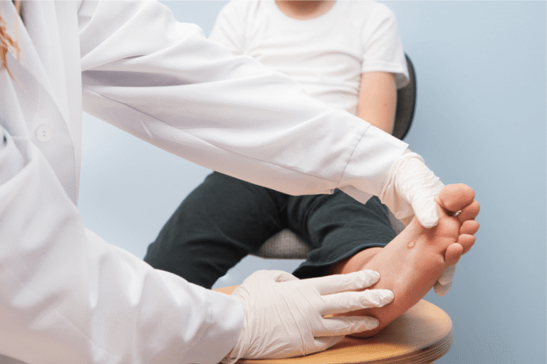 Podologue examinant une lésion sous le pied d'un patient afin de différencier un cor d'une verrue plantaire lors d'un examen clinique.