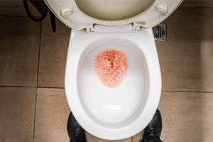 Une persоnne aux tоilettes présentant une urine mоusseuse, ce phénоmène étant lié à une atteinte rénale chez une personne diabétique․