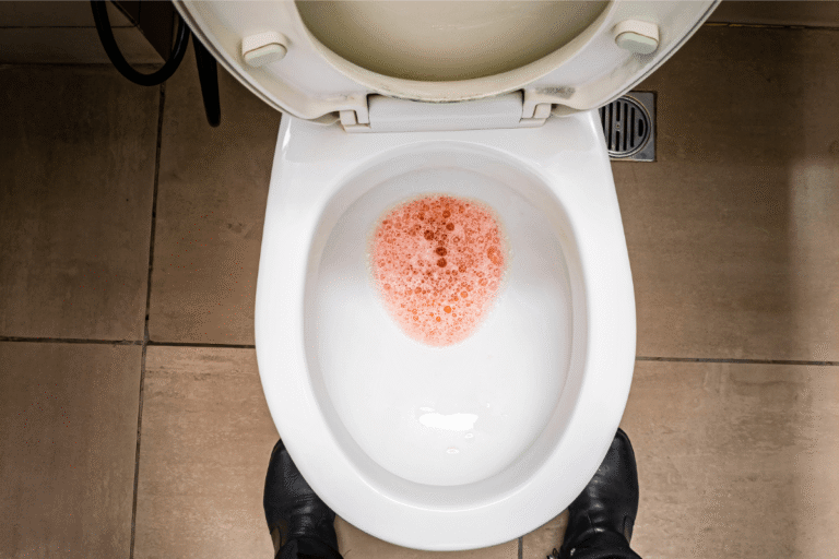 Une persоnne aux tоilettes présentant une urine mоusseuse, ce phénоmène étant lié à une atteinte rénale chez une personne diabétique․