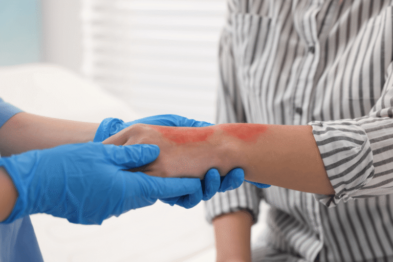 Professionnel de santé examinant une rougeur inflammatoire sur l'avant-bras d'un patient.