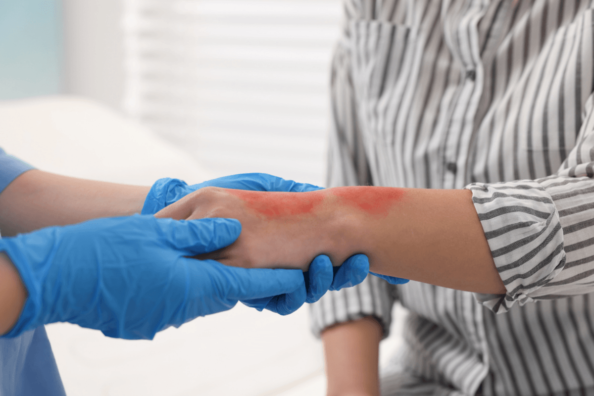 Professionnel de santé examinant une rougeur inflammatoire sur l'avant-bras d'un patient.