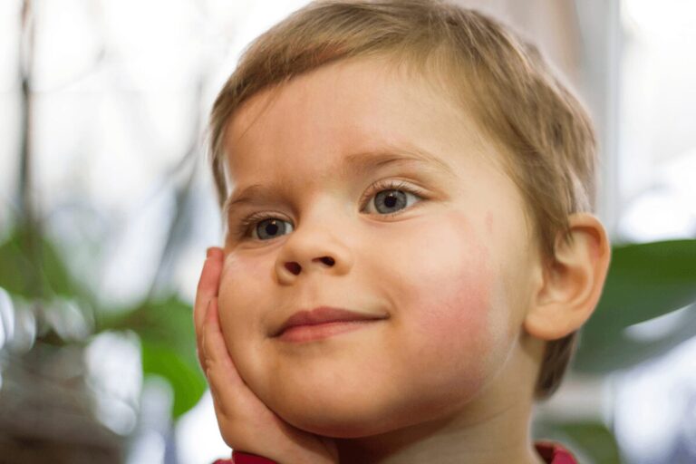 Gros plan sur un jeune enfant aux joues rouges, suspectant le Parvovirus B19, la main posée sur le visage.