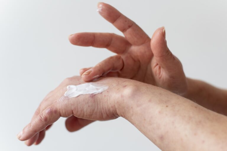 Crème pour peau atopique