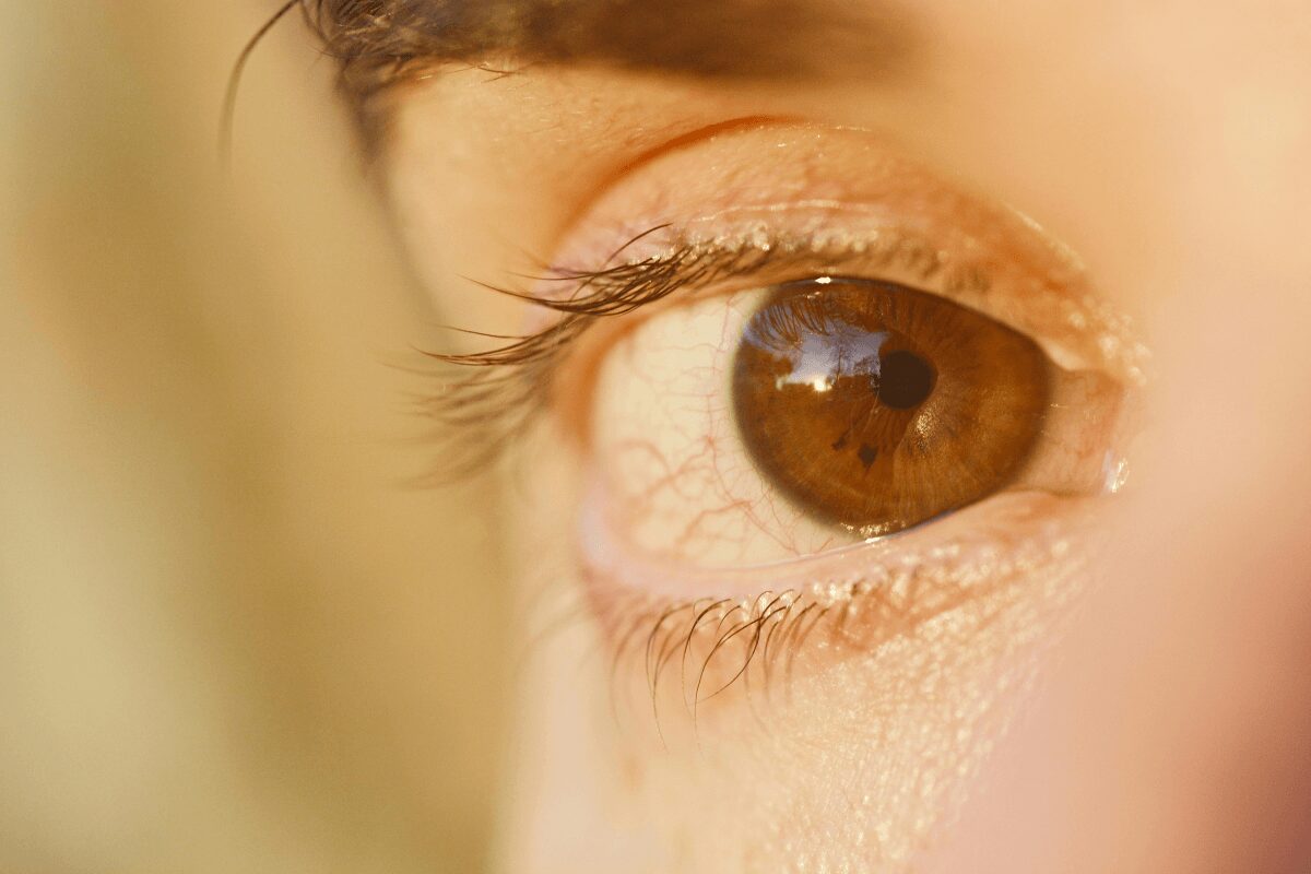 Gros plan sur un œil exposé à une forte lumière, illustrant la sensibilité oculaire provoquée par une photokératite.