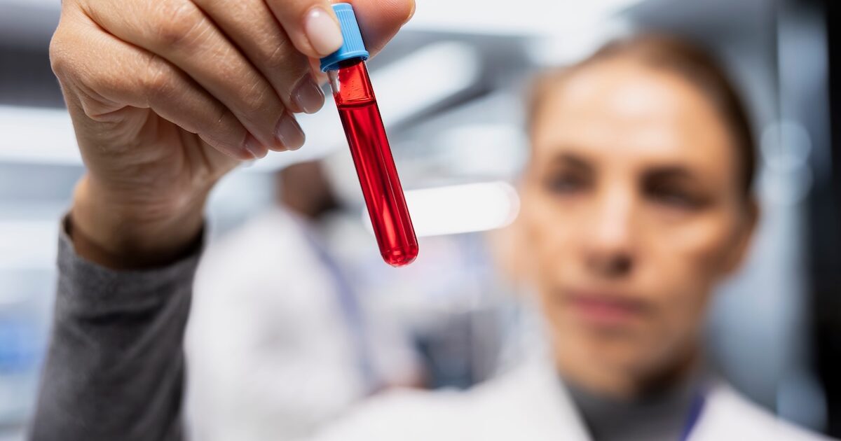Can Menstrual Blood Diagnose Endometriosis? French Researchers Find Hope