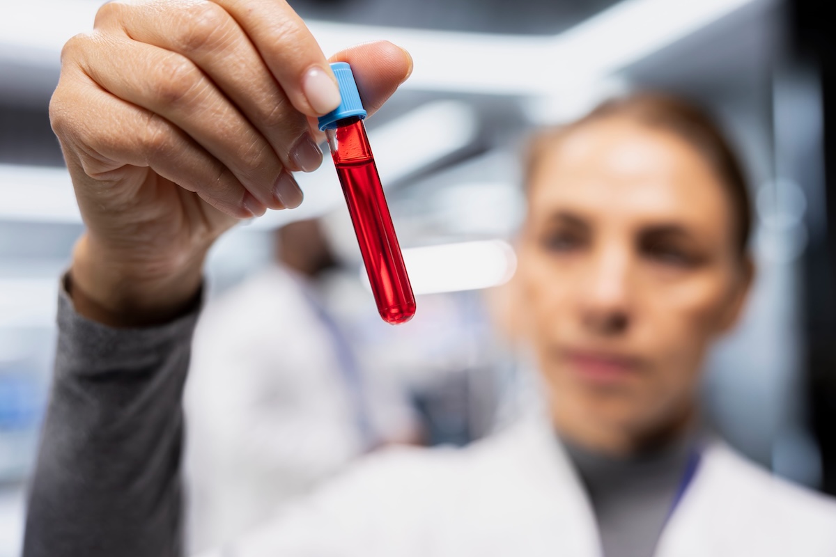 Une chercheuse observe un échantillon de sang menstruel en laboratoire, dans le cadre de recherches visant à mieux détecter l’endométriose.