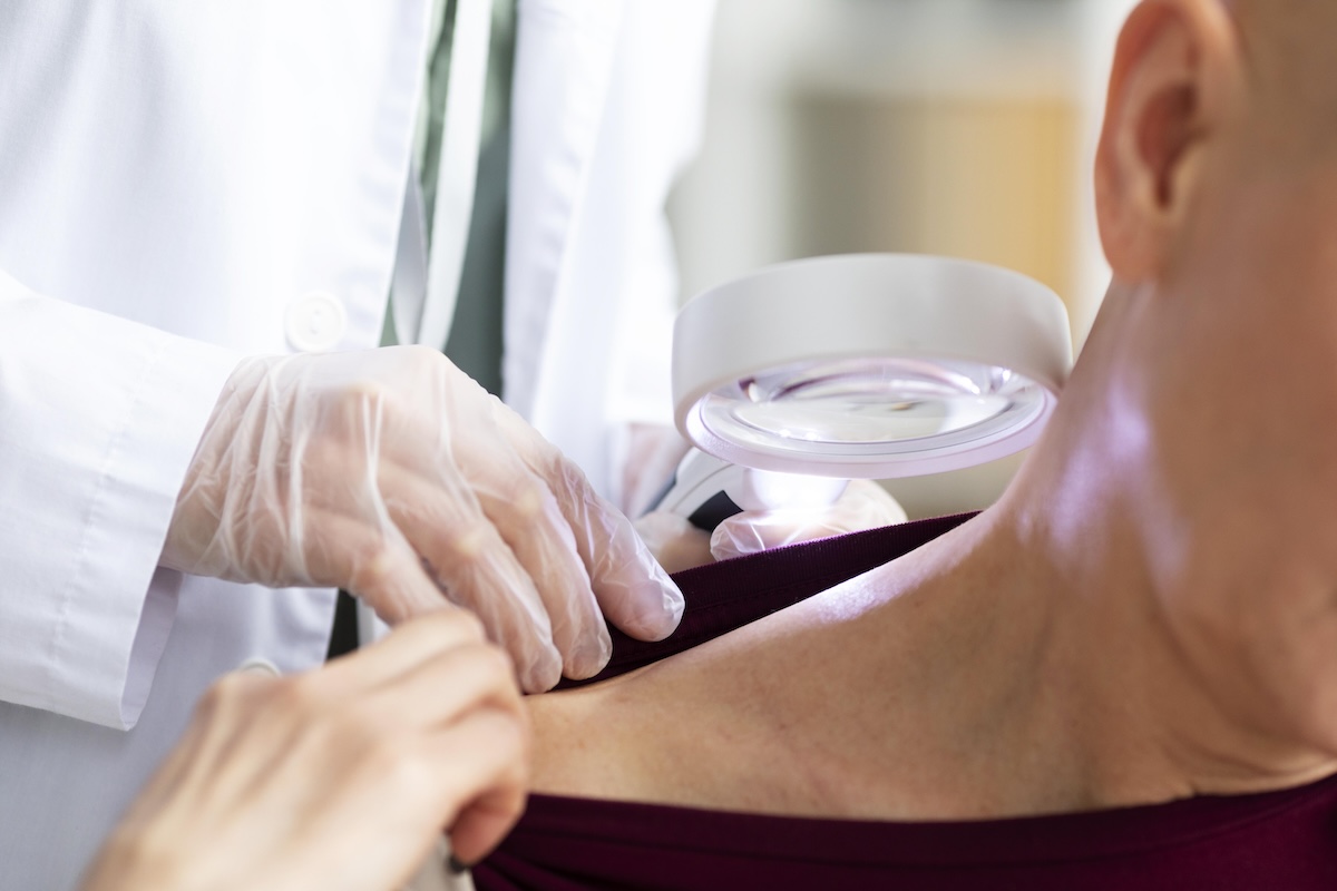 Un dermatologue examine la peau du cou et de l'épaule d'un patient à l'aide d'une loupe lumineuse, à la recherche d'éventuelles lésions cancéreuses.